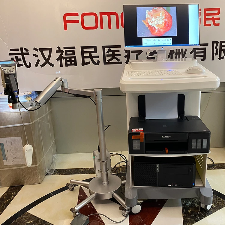 Good quality  C6HD vaginal colposcopy gynecological disease diagnostic instrument that can be customized