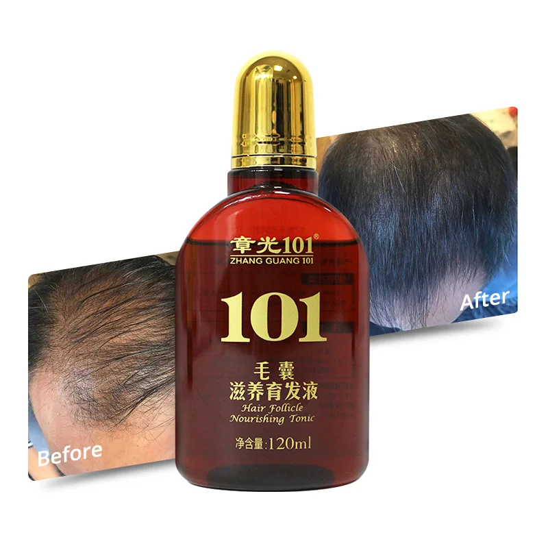 OEM Organic Rapid Hair Growth Serum Nourishing Hair Follicles with Ginseng and Peppermint 12ml Hair Growth Spray for Home Use