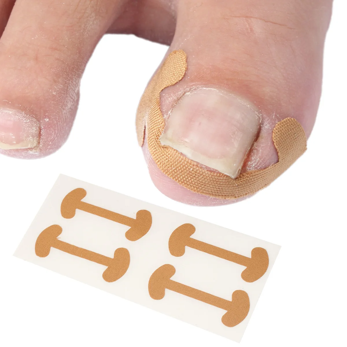 48 Pcs Ingrown Toenail Treatment  Health Toenail Correction Stickers Professional Glue-Free Toe Nail Treatment Tool Foot Care