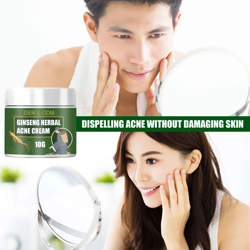Facial Skin Care vitamin E Cream Anti-Acne  Acne Scar Removal Natural Herbal Extract Herbal Acne Removing Cream