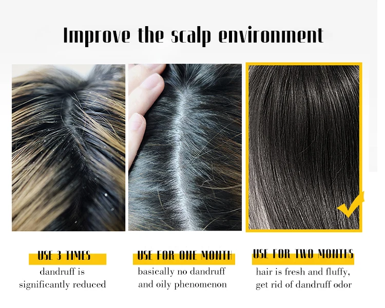 hair shampoo anti dandruff