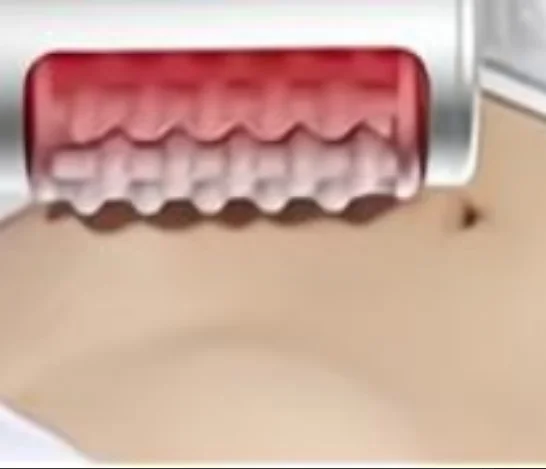 360 Degree BCM Cellusculptor  EN7   Massager Bodi Slim Roller Slimming  Inner Ball Roller Machine Bodi Cellulite Device