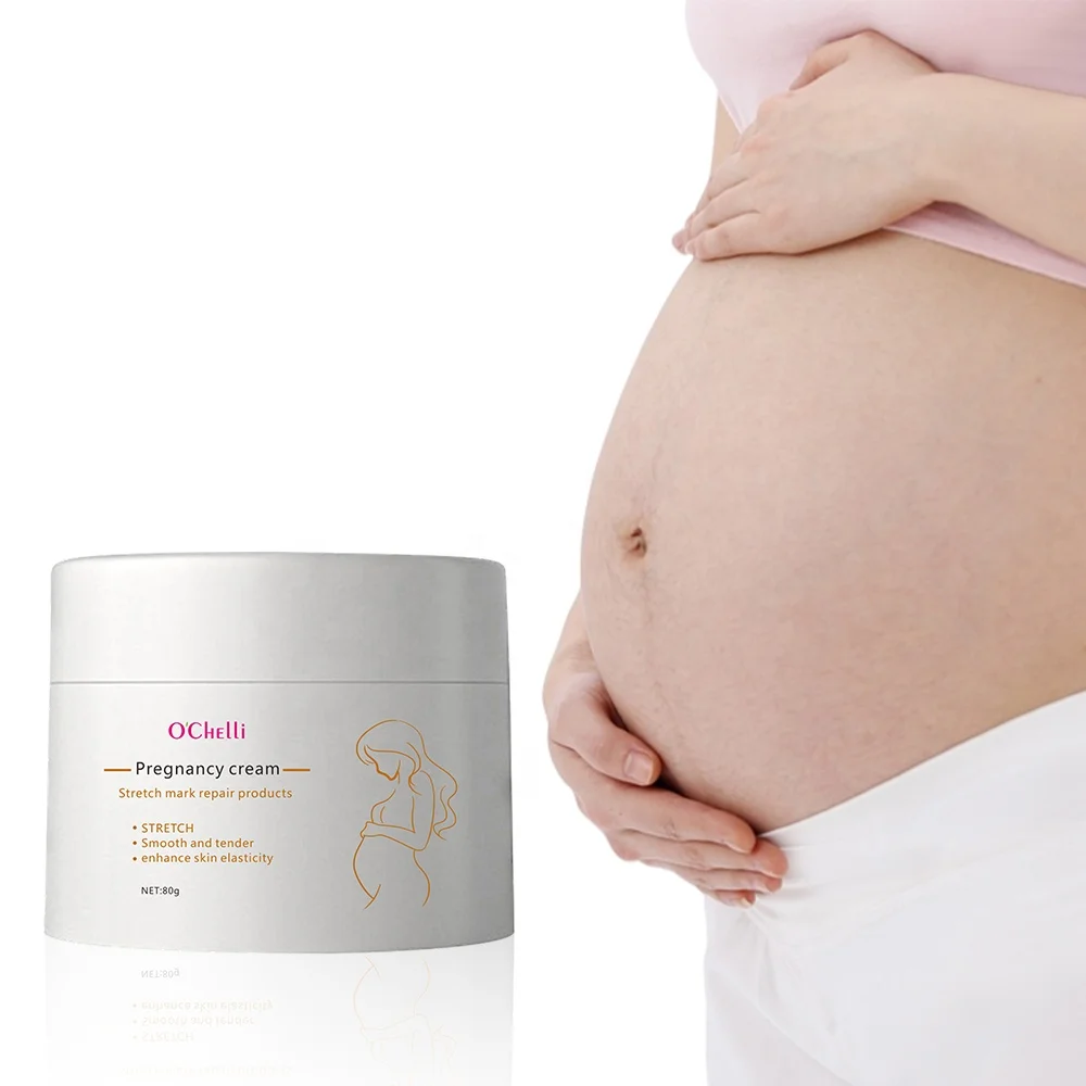Wholesale Private Label Best Natural Pregnancy Scar stretch marks removal cream