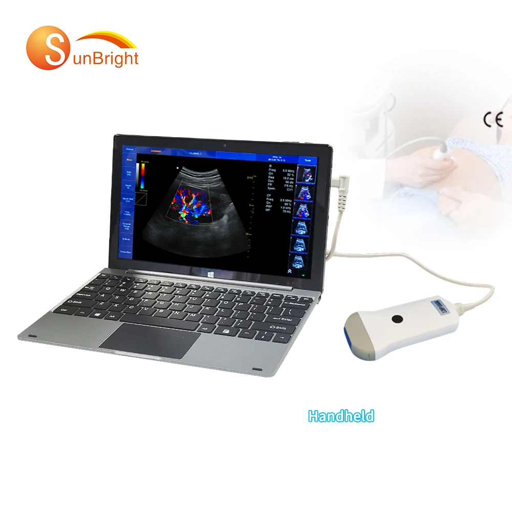Color Doppler echocardiogram ultrasound phased array probe professional