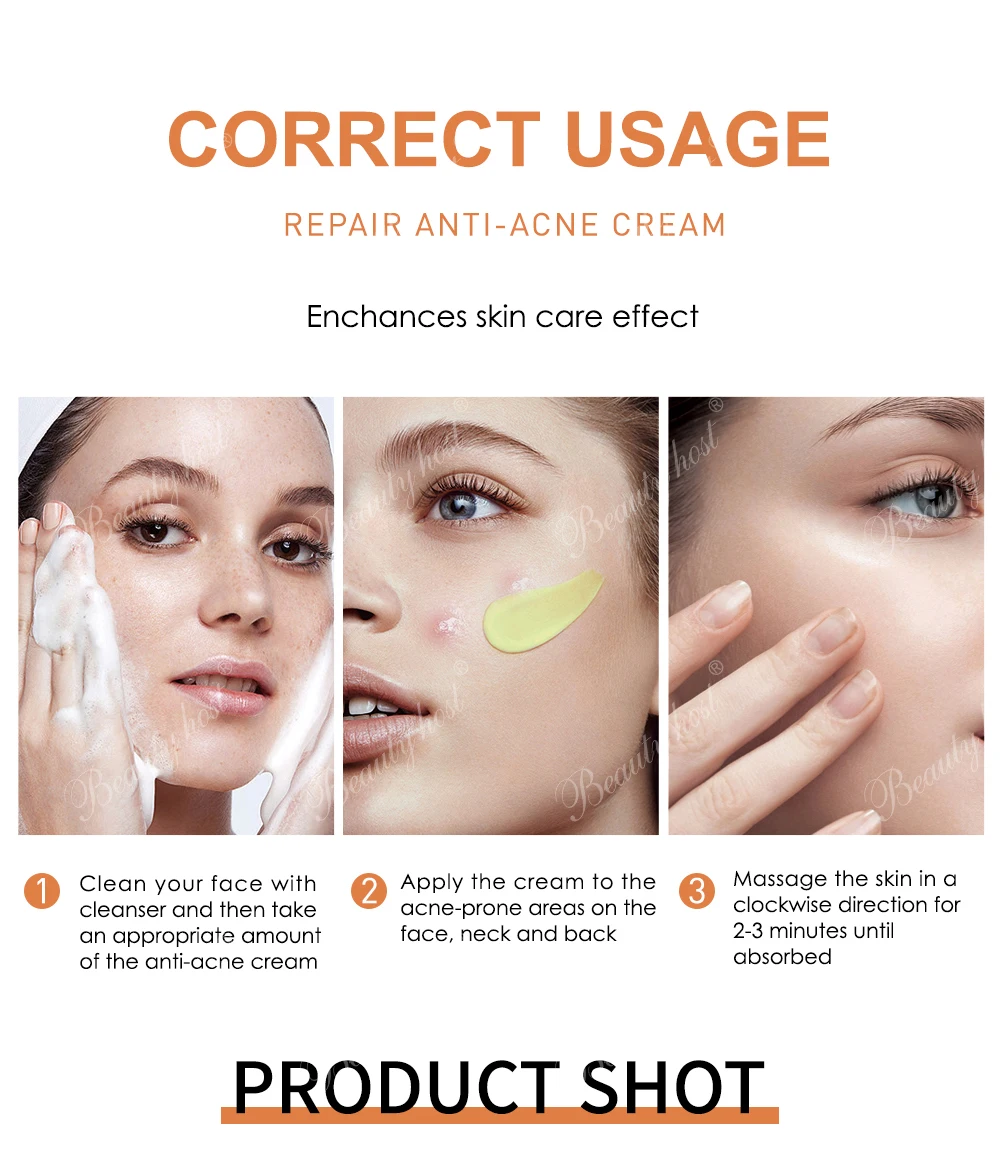 Acne Solution Face Cream Pure Repairing Soothing Acne Scar Removal No Side Effect Moisturizer Glowing Pimple Dark Spot Treatment