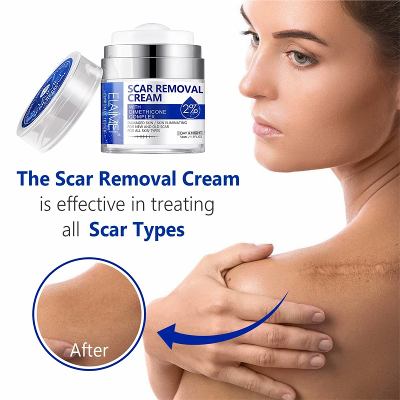 ELAIMEI 50ml skin repairing brightening stretch marks acne removing skin care cream for scars after surgery