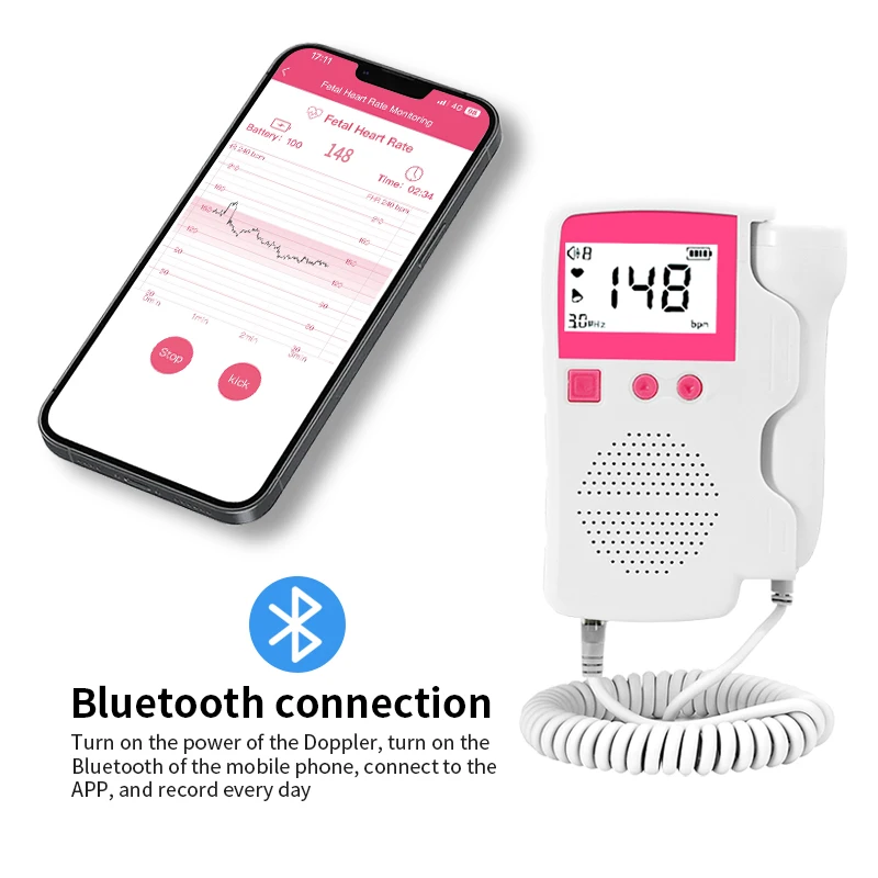 Mini Handheld Fetal Doppler CE certified Monitor Baby Heart Beat Doppler App Record Heart Rate