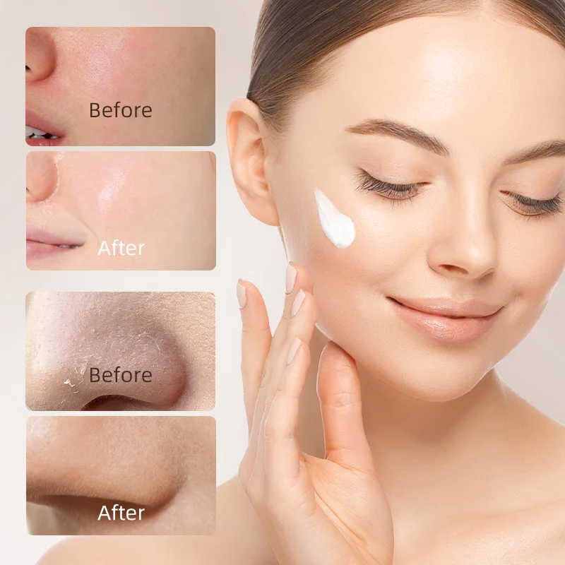 skin caring manufacturers anti aging donkey milk face cream collagen face cream organic face care brightening