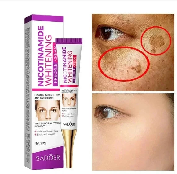Whitening Cream Repairing Freckle Pigmentation Improving Dark Yellow Smoke Amide Reducing Melasma Facial Whitening Cream