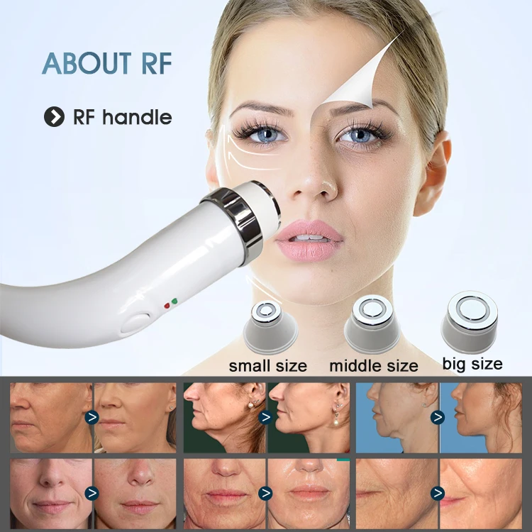 2024 upgrade 4 in 1 multifunctional SPRT SHR IPL rf e-light nd yag lasering machine