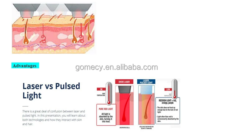 GOMECY-Multifunction-beauty-machine-3-in-1-elight-ipl-opt-rf-nd-yag-ipl-laser-hair-in-Beijing