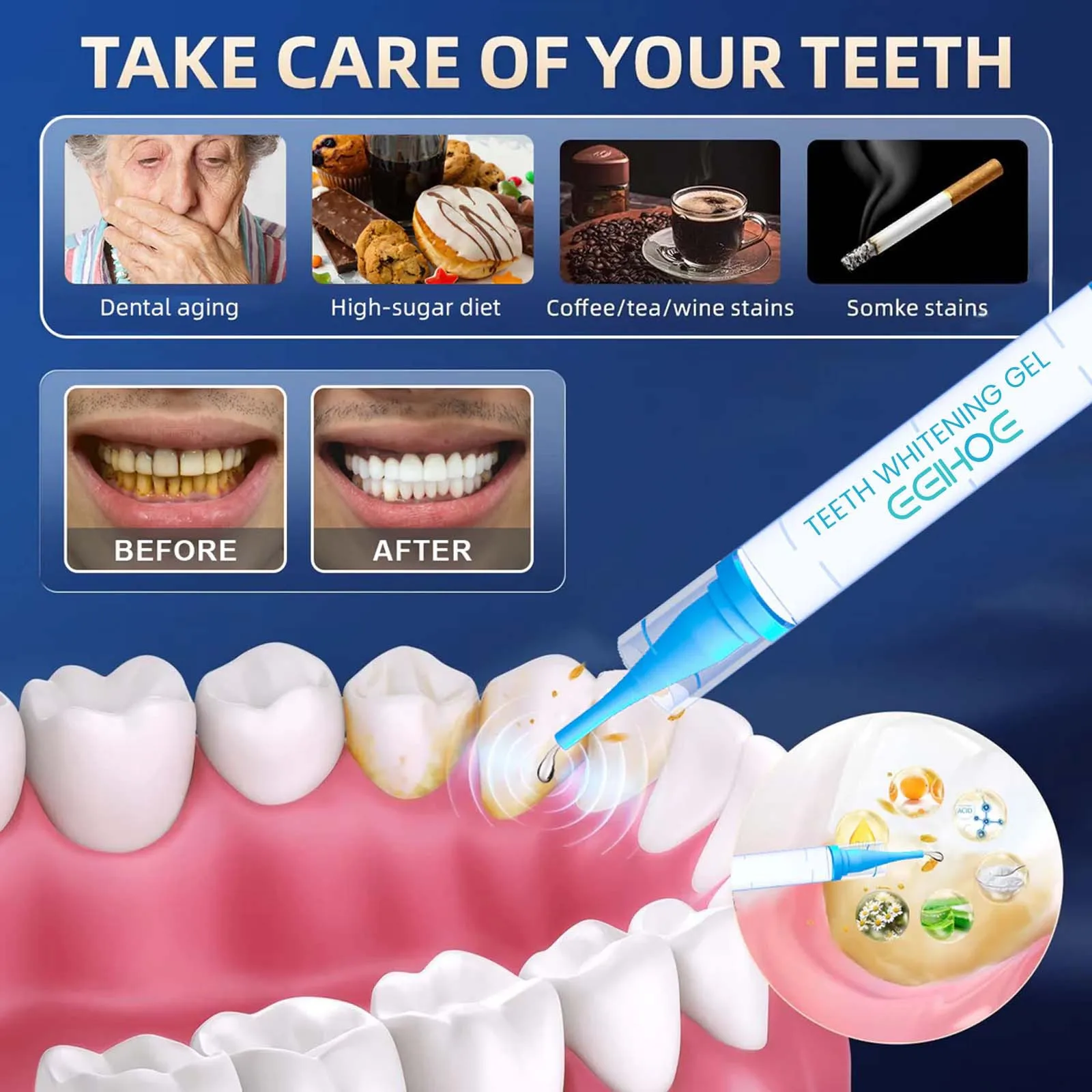 Professional Teeth Whitening Gel Dental Whitening Gel Tooth Whitening Gel