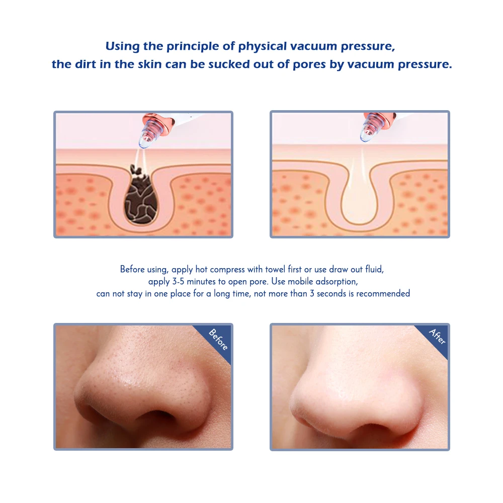 Facial Massage Electric Five Suction Pore Cleaner Dermabrasion Pore Skin Cleaner Vacuum Suction Blackhead Remover.jpg