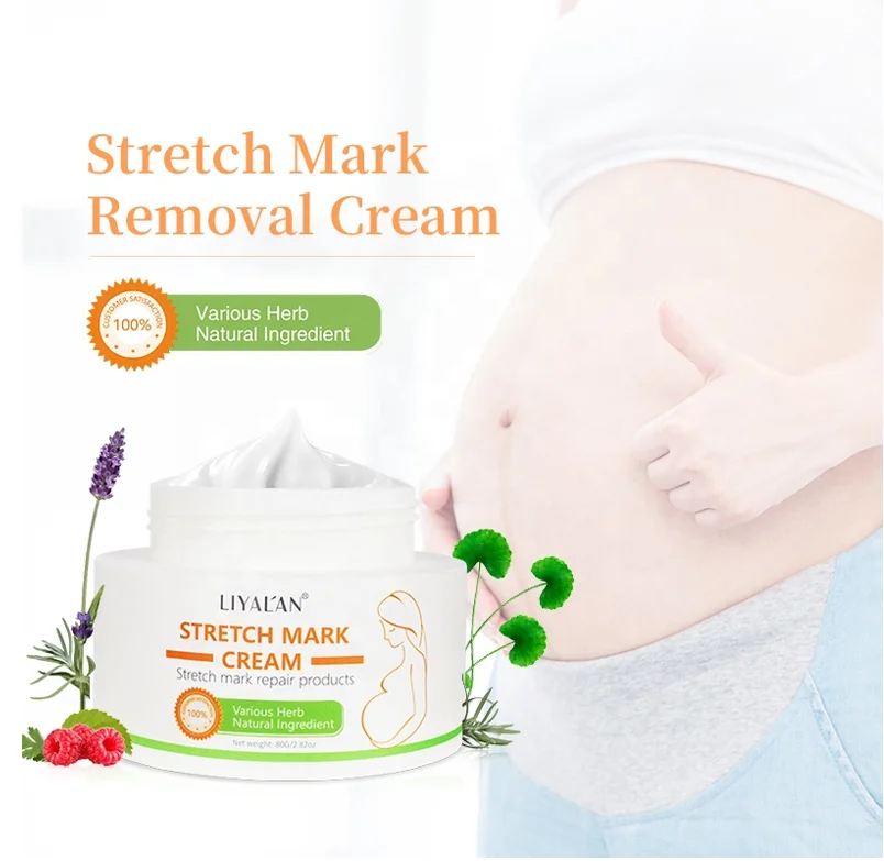  Private Label Stretchmark Remover Cream Natural Organic Body Scar Repair Slack Line Pregnancy Abdomen Anti Stretch Mark