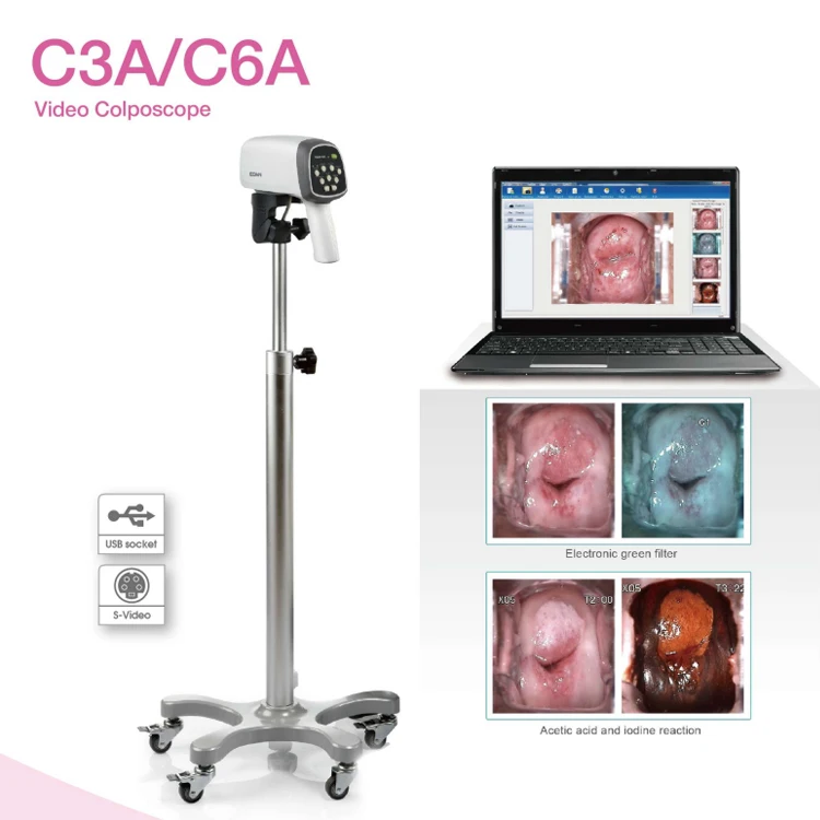 Edan C3 C6 C3A C6A Digital Video Colposcope HD High Definition Digital Imaging Vaginal Colposcope for Gynecology