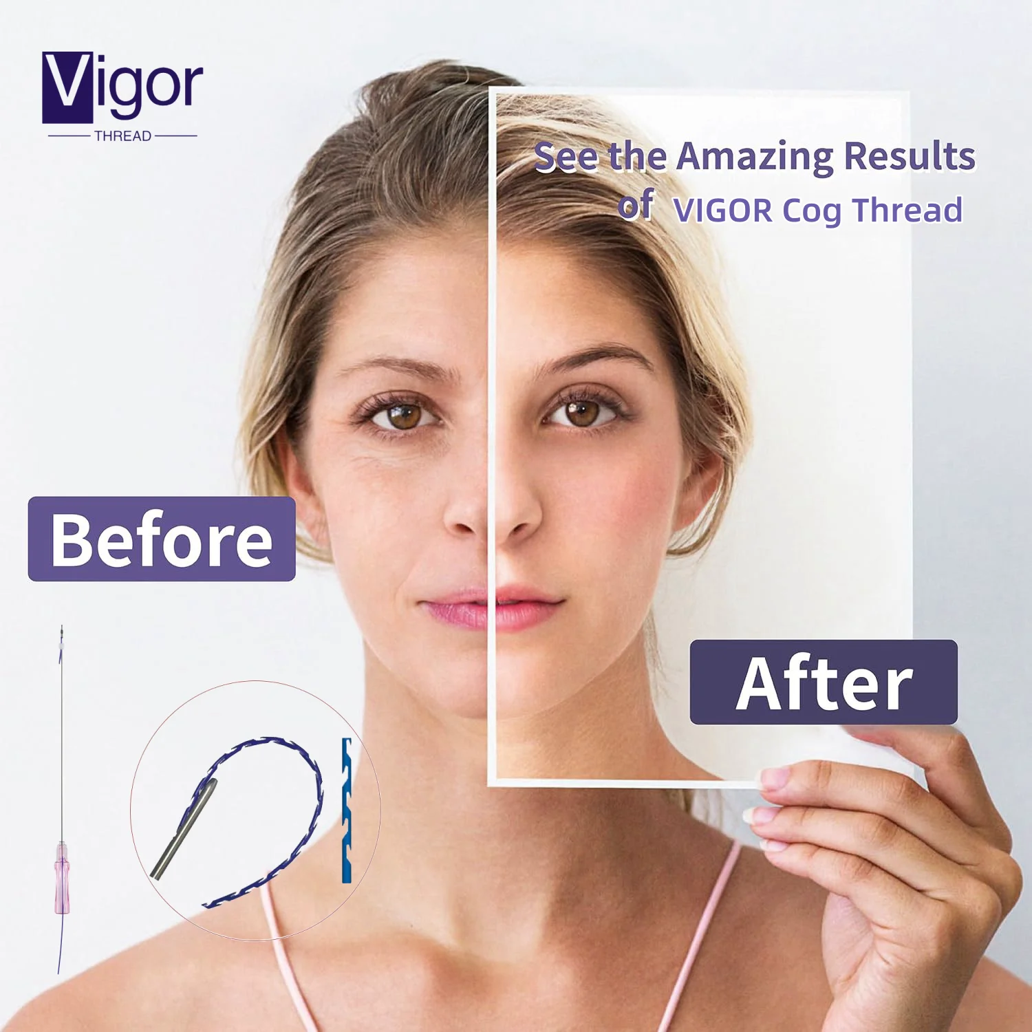 VIGOR hilos pdo eye korean hilos fishbone cog 8d 18g 100mm 21g 100mm hilos pdo mono 29g x 38mm
