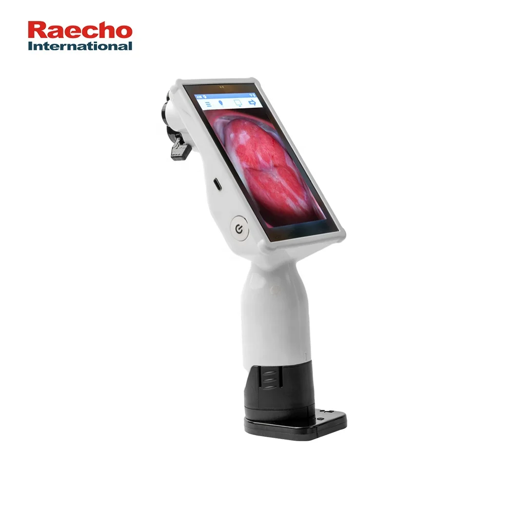 Профессиональный медицинский цифровой кольпоскоп видео вагинальная гинекология