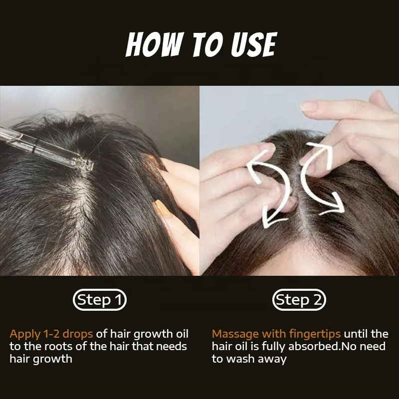 OEM Custom Private Label Hair Treatment Smooth Repair Hair Loss Thicker Ginger Hair Growth Oil Serum
