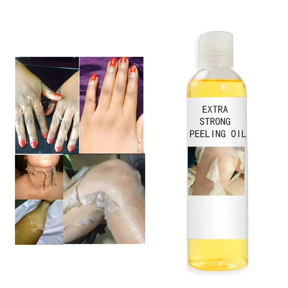 Private Label Extra Strong Peeling Oil Whitening Yellow Peeling Oil