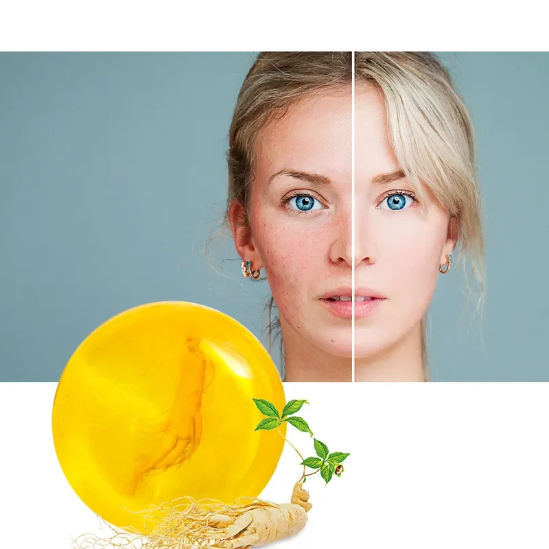 100 g Handmade Soap Ginseng Soap Herbal Oil Whitening Face Body Home Use Soap