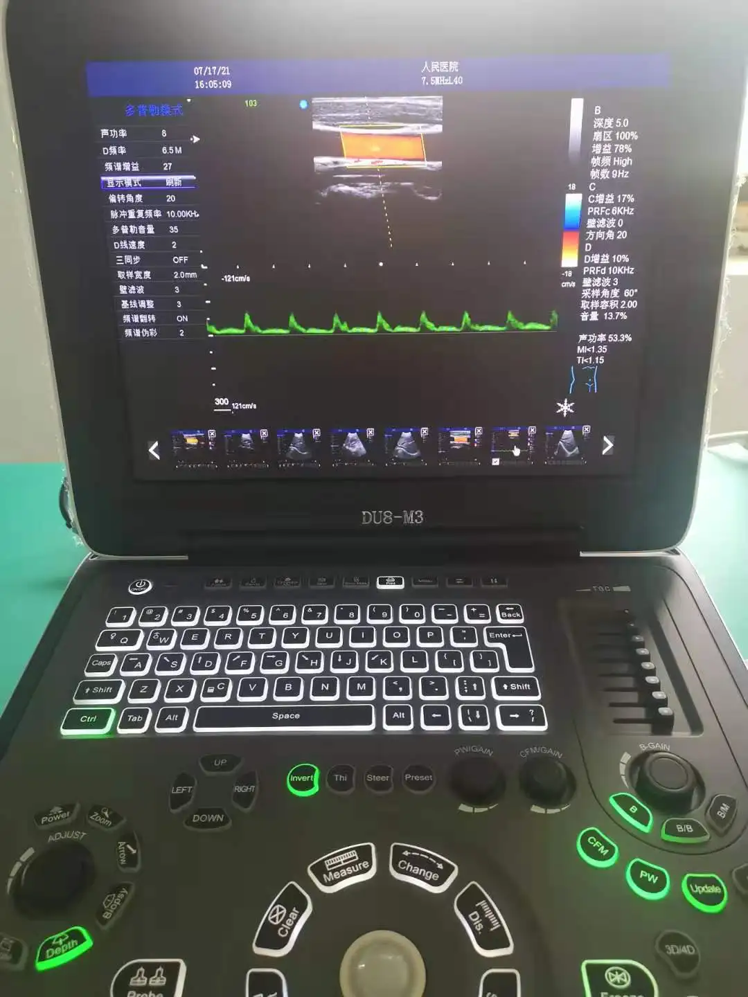 medical ultrasound instruments RUIHUA DU8-M1 model with two probe connectors Laptop Doppler Ultrasound  Echo Machine