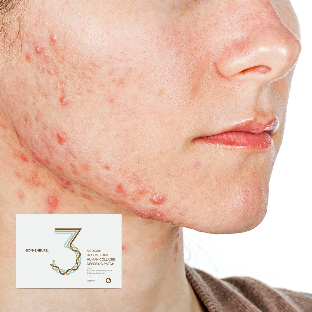 Professional Beauty Recombinant Human Type III Collagen Repair Facial Mask Dressings Patch For IPL Hydro Repair