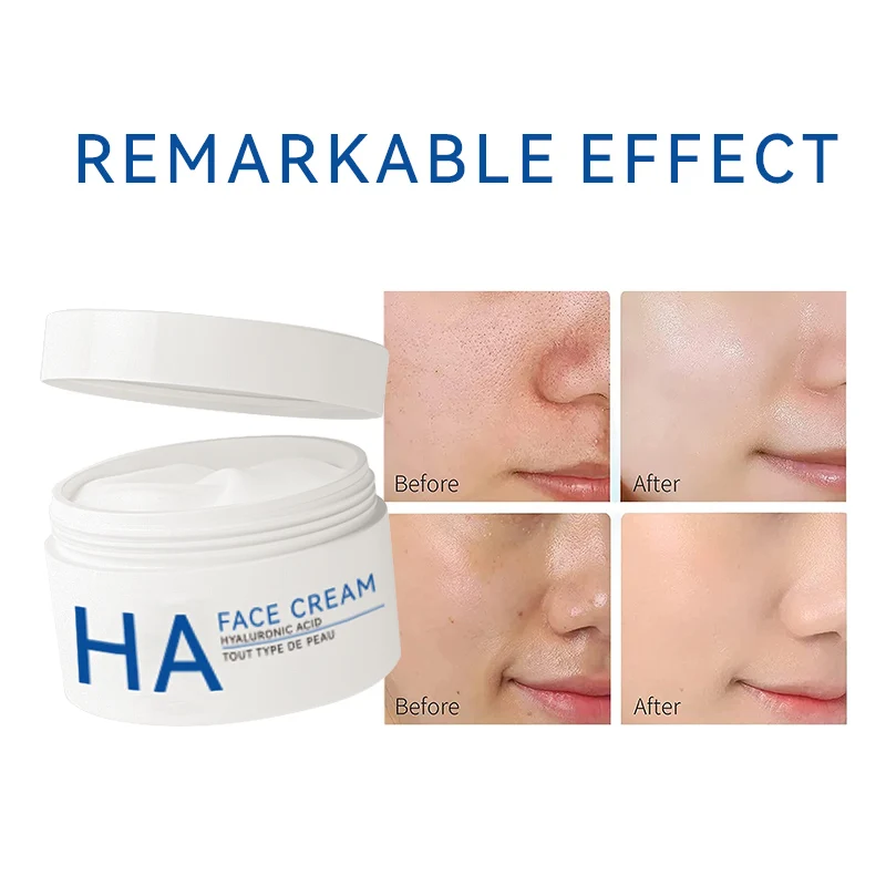 Enjoy Skin Hyaluronic Acid Moisturizer Face Cream Moisturizing Smooth Soft Hydrate Face Men Women Use Factory Sell
