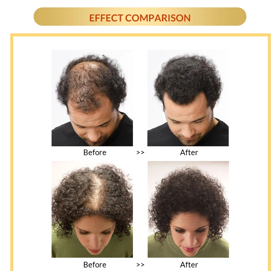 Быстрая эффективная Сыворотка для роста волос 7 дней лечение кератина для остановки падения волос