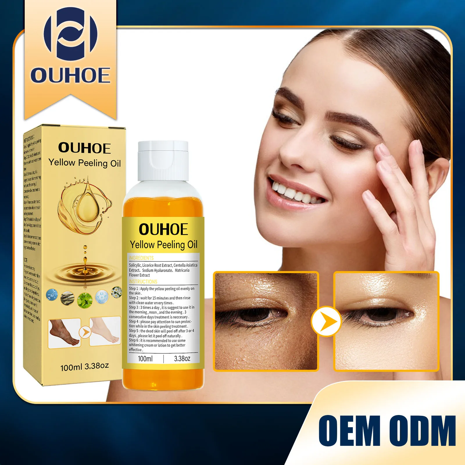 OUHOE Yellow Peeling Oil Supplier Nourishing Whitening Organic Lightening