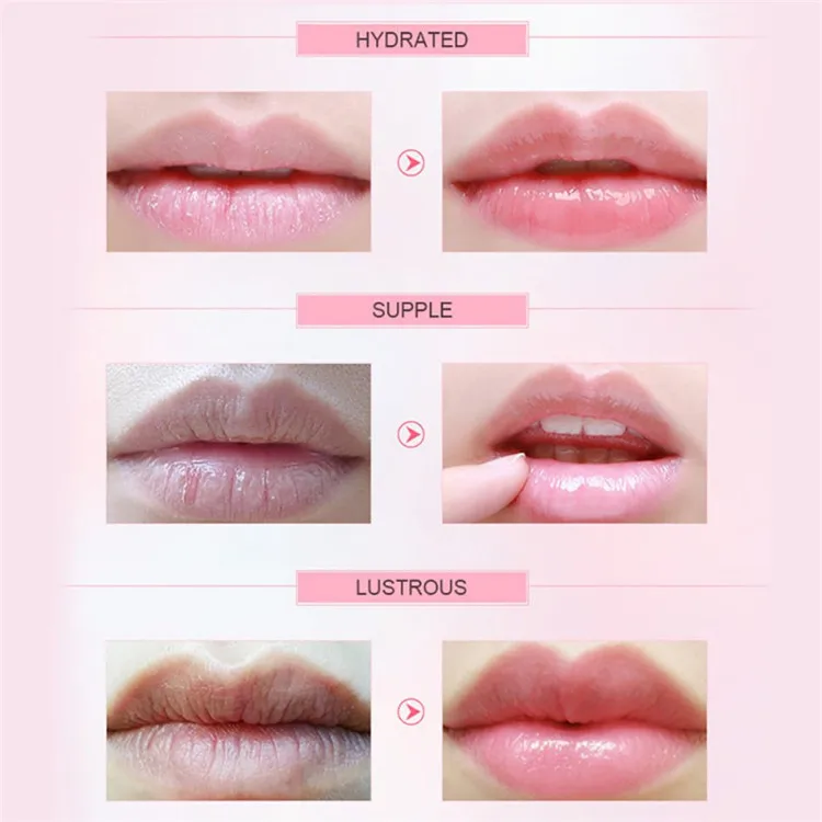 Pink Gel Collagen Lip Mask Crystal Lip Pads For Moisturizing, Anti-Wrinkle, Anti-Aging