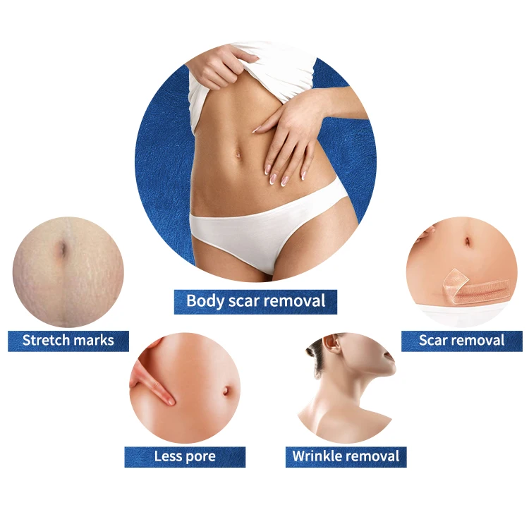 portable skin beauty facial High frequency radio fractional potenza rf microneedling machine with cold hammer