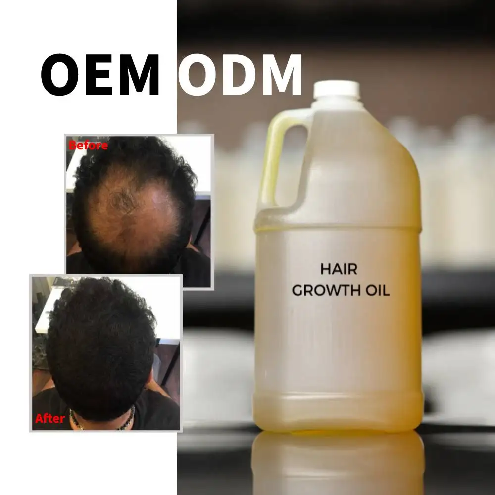 Produtos mais vendidos para crescimento de cabelo de fazer crescer cabelo