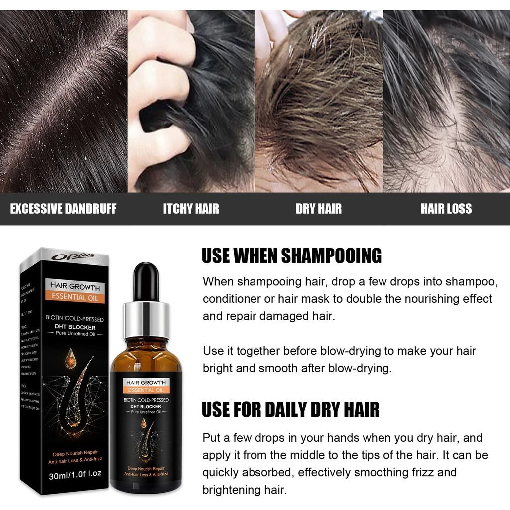 Opal OEM China Best Premium custom logo men herbs Ginger hair growth oil original dht blocker hair growth oil
