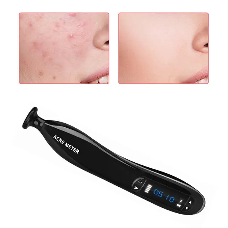 Most Popular Salon Spa Home Use Plasma Ozone Facial Machine Wand Plasma Ozone Facial Machine Wand