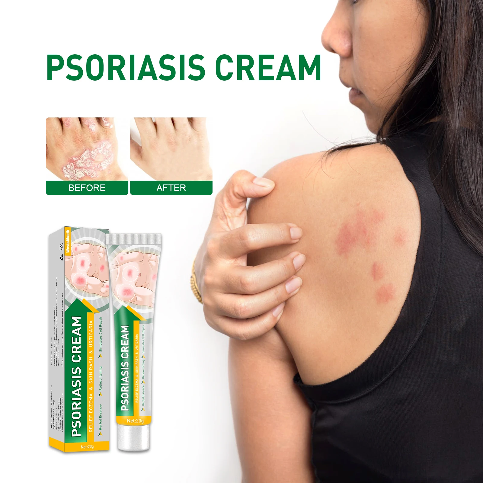 Custom logo Herbal Bacteriostatic Cream Psoriasis Dermatitis Ointment Anti-itching Skin Problems Antifungal Cream