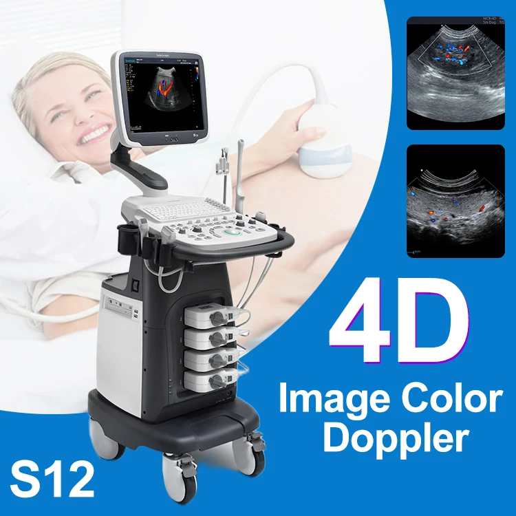 Sonoscape S12 Trolley Color Doppler Cardiac ultrasound machine China price