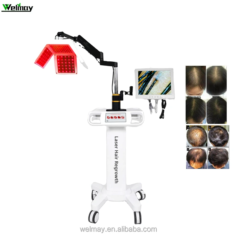 Newest Design Laser Hair Fall And Hair Growth Treatment Scalp Care Pdt Led Light Therapy Hat Laser Hair Growth