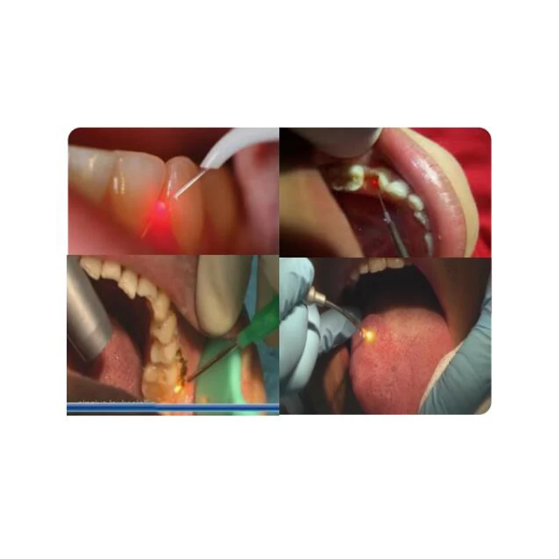 MY-M059H Dental equipment cosmetic laser dental teeth whitening machine dental diode laser systemsm