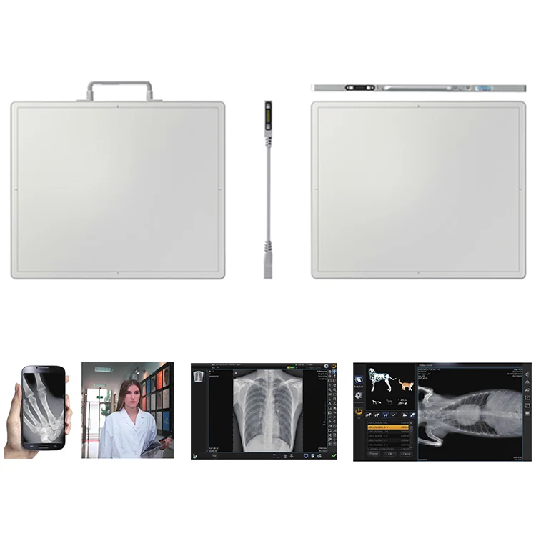 YSFPD4343A Wired/wireless veterinary/human software cassette-sized x-ray digital detector DR flat panel for hospital