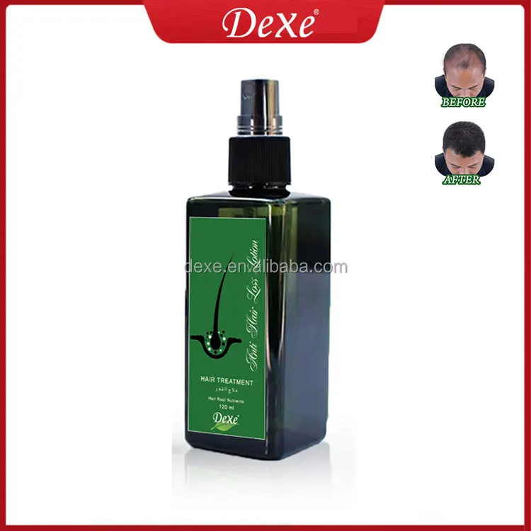 Dexe herbal instant hair grow spray hair growth men and women wholesale anti hair loss lotion
