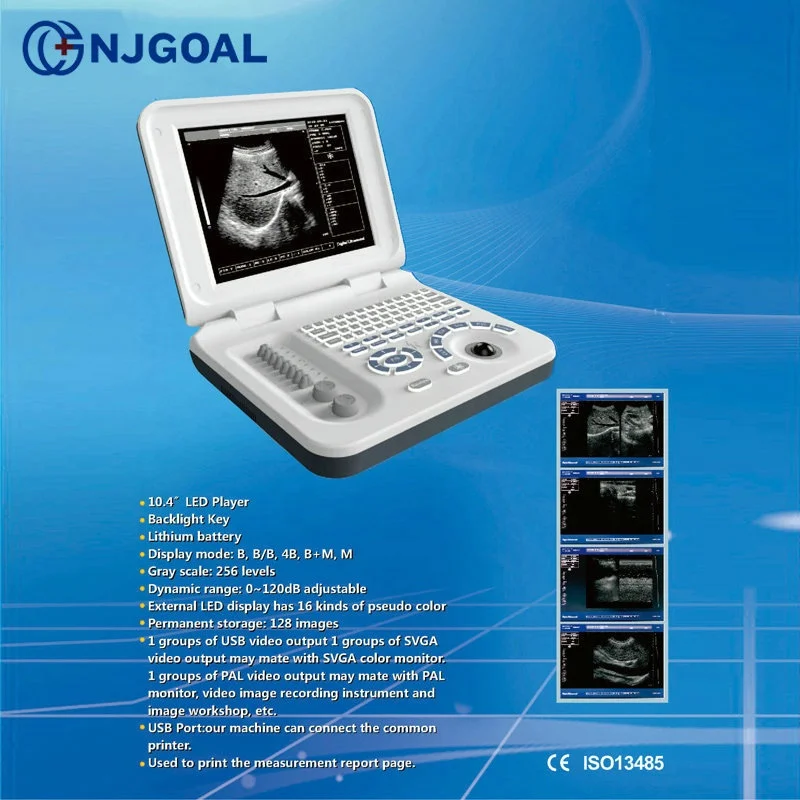 Новый продукт запуск в Китае беременность недели измерения полный цифровой 3d ультразвуковая машина цена