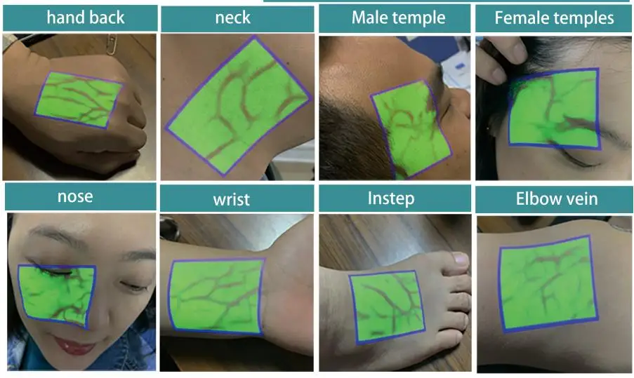 portable nurse vein viewer infrared vein scanner detector finder locator device nursing aids vein finder detector