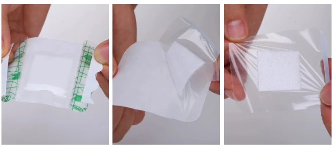 Hot sale Guangyi waterproof  Wound Dressing Medical Supply China manufacture