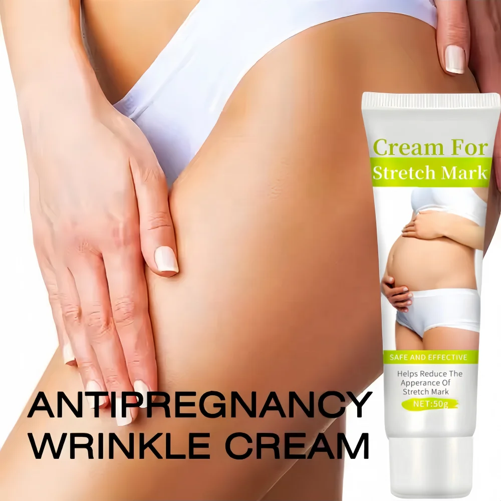 Hot sale anti-stretch mark oil cream removal stretch marks black skin treatment skin repair Fade Stretch Marks Cream