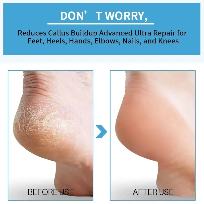 Wholesale Foot Skin Care Heels Deodorant Urea 40% Orgainc Ingredient Exfoliating Nourishing Moisturizing Peeling Foot Spray 50ML