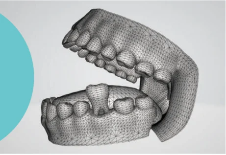 First-class Precision And Quality  Glorious Meta Series Intraoral Scanner For CAD/CAM