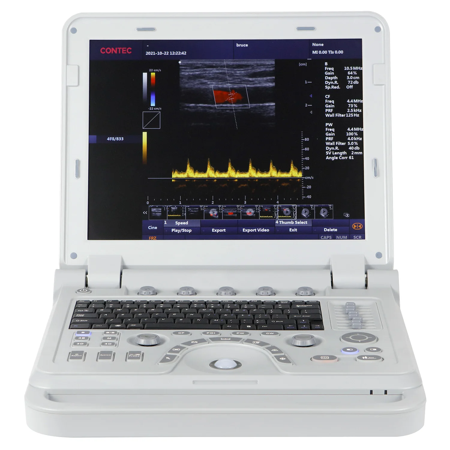 CONTEC CMS1700A colour doppler ultrasound scanner 3in 1 wifi  portable ultrasound table