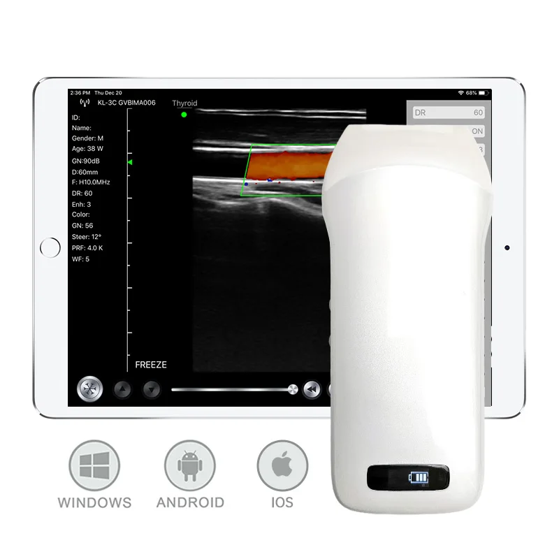 Wh-9 Medical Ultrasound Instruments 7.5-10mhz Site-rite Ultrasound Wireless Wifi Siterite Vascular Ultrasound Probe For Android
