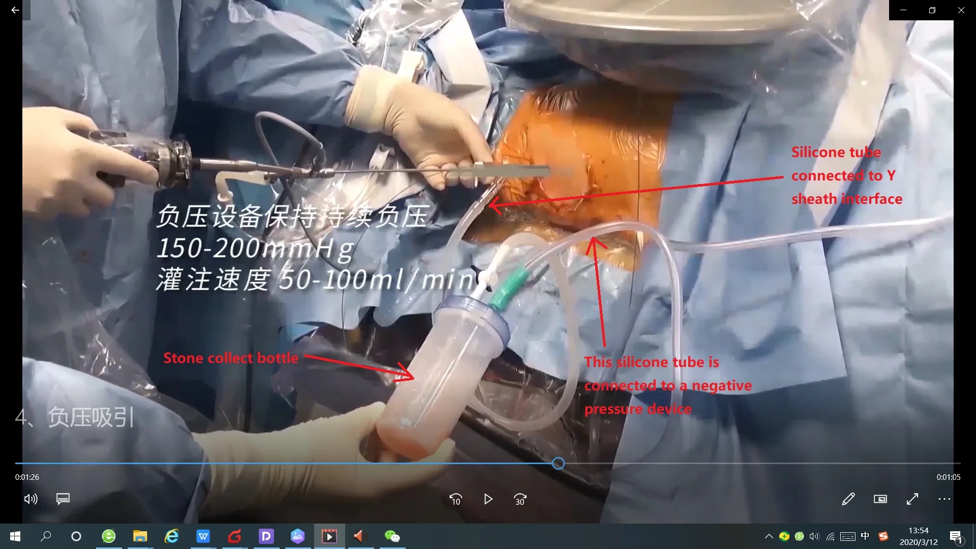 
Silicone Medical Closed Wound Drainage System with Negative Pressure Suction Reservoir Plastic Ce 1 YEAR Manual Class I 1years 