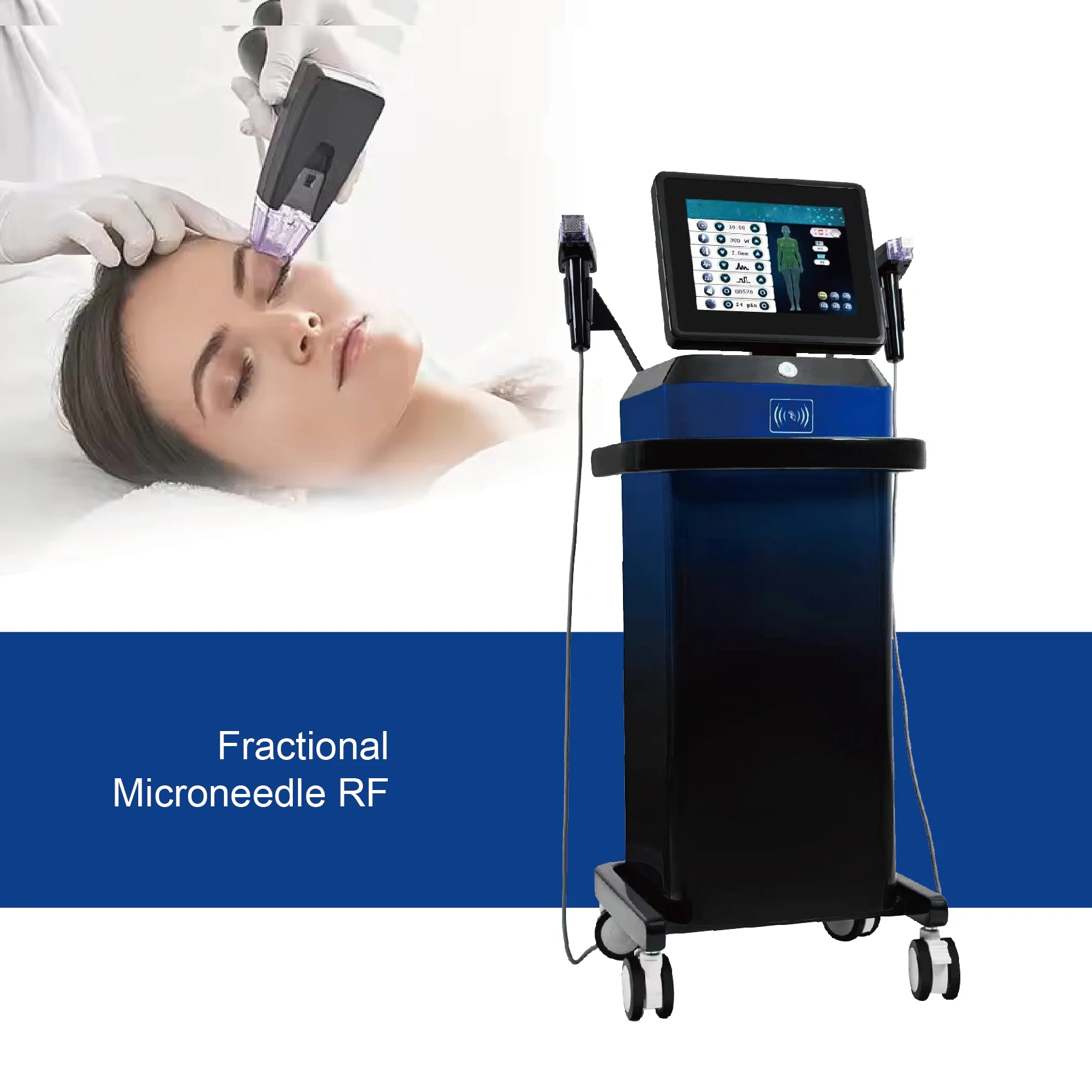rf fractional microneedling stretch mark removal Radio frequency fractional rf microneedle face lift machine